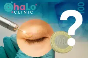 הסרת קסנטלזמה בלייזר – מחירון ועלויות בישראל | Halo Clinic