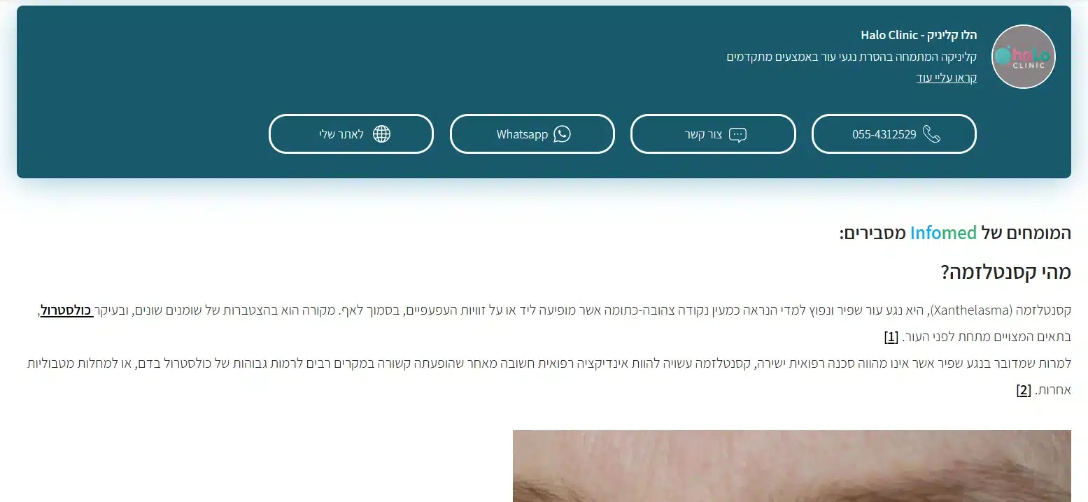 קסנטלזמה בעפעפיים – המחשה