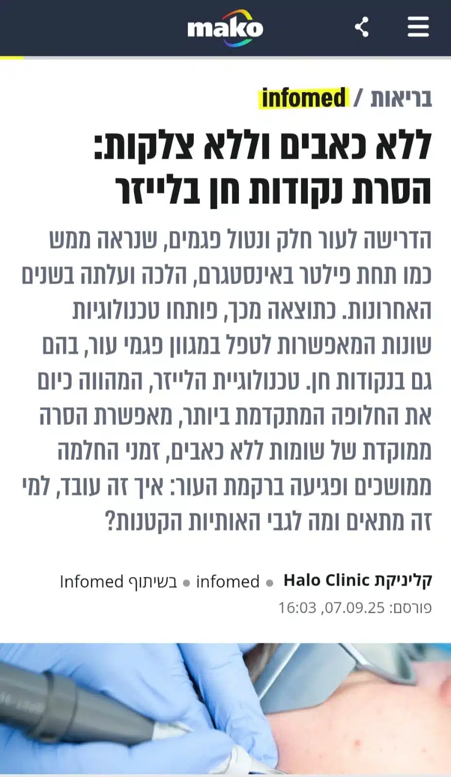 כתבה במאקו בריאות: הסרת נקודות חן – Halo Clinic